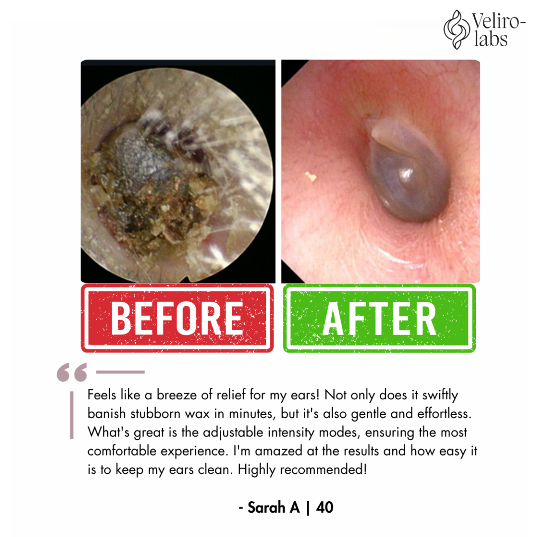 Veliro-Labs: Doctor Approved   Ear Wax Remover
