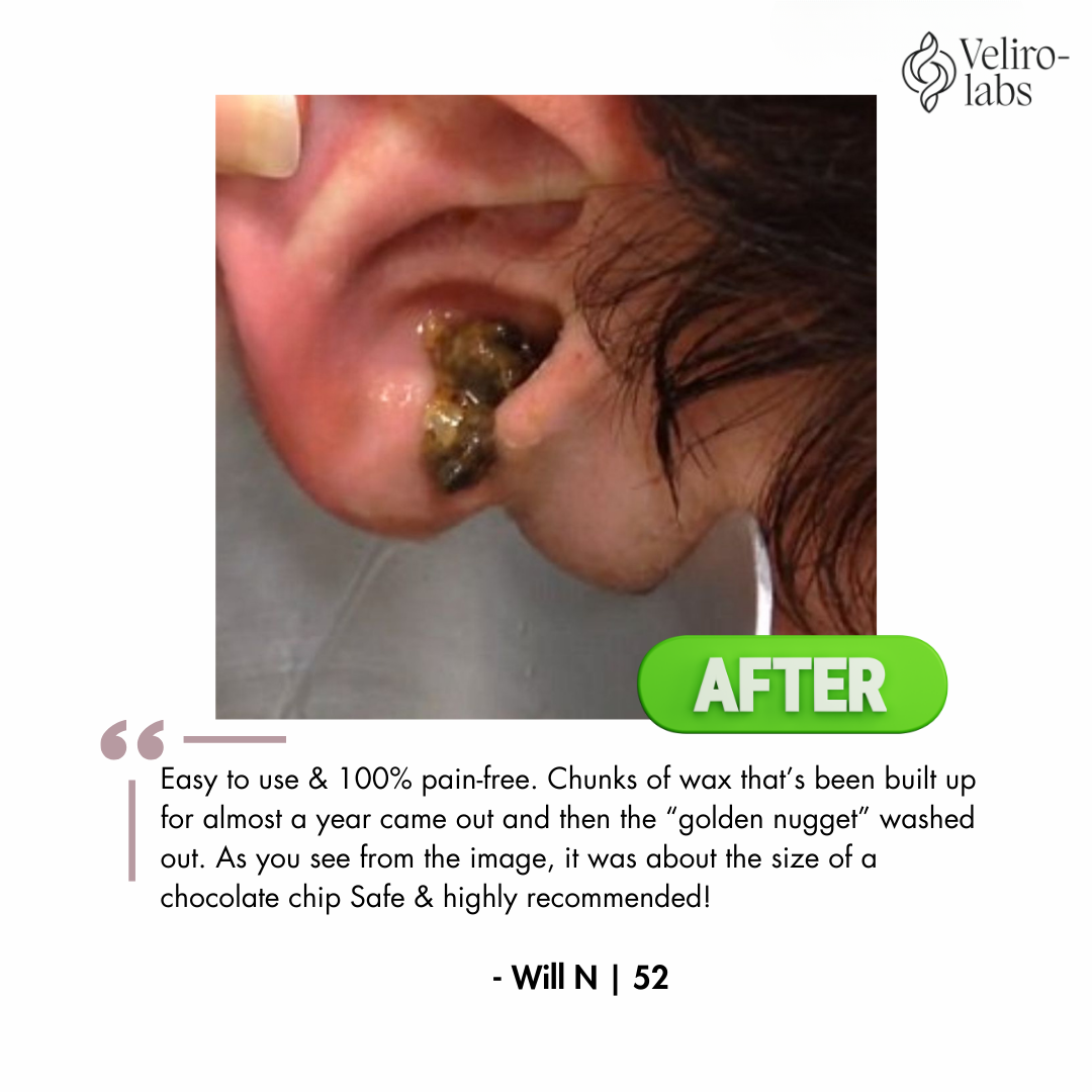 Veliro-Labs: Doctor Approved   Ear Wax Remover